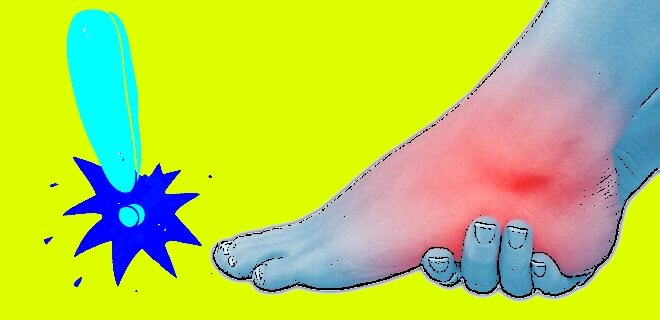 https www neoldu com ayak bilegi kireclenmesi h htm