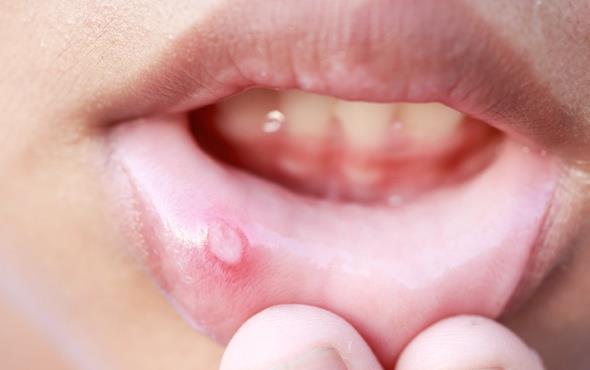 aft nedir aft nasil gecer