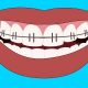 Ortodontik tedavi ne demek?