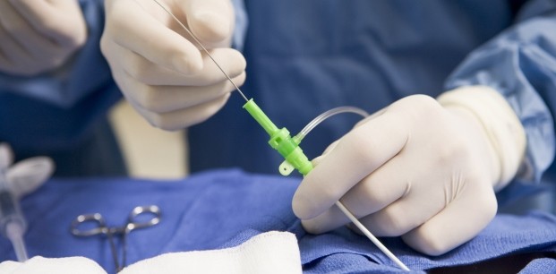 anjiyo nedir neden yapilir