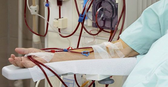 bobrek diyalizibobrek diyalizi nedirbobrek diyalizi hakkinda bilgi h