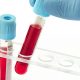 Kan Grubuna Göre Karakter Analizi Nasıl Yapılır?