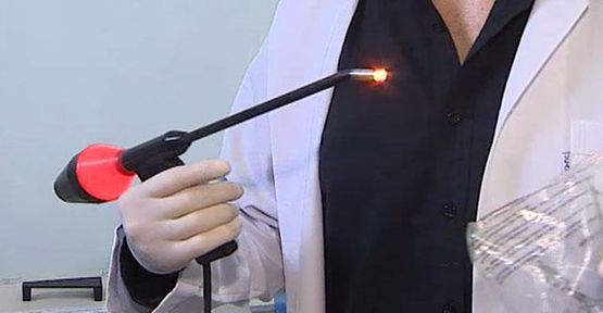 lazer cerrahi lazer cerrahi nedir lazer cerrahi hakkinda detayli bilgi h