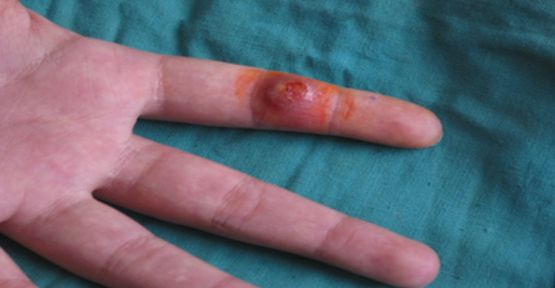 sarbon nedirsarbon hakkinda detayli bilgi h